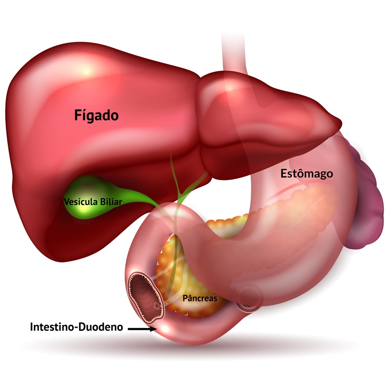 Pedra na Vesícula 1